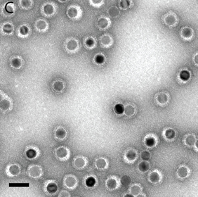 Iron oxide nanoparticles (NP-N3) encapsulated into hepatitis B virus (HBV) OTHER [STATIC IMAGE] model